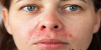 კანის გაღიზიანების მკურნალობა.ძალიან ხშირია პირბადით გამოწვეული გაღიზიანება,სახლში მოუარეთ კანს ყველაზე იაფად.