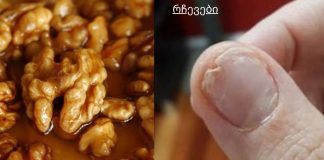 მიირთვით ეს, თუ გაქვთ მტვრევადი ფრჩხილები, უძილობა და ზედმეტი თმის ცვენა