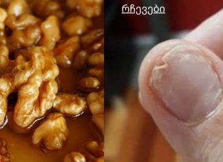 მიირთვით ეს, თუ გაქვთ მტვრევადი ფრჩხილები, უძილობა და ზედმეტი თმის ცვენა