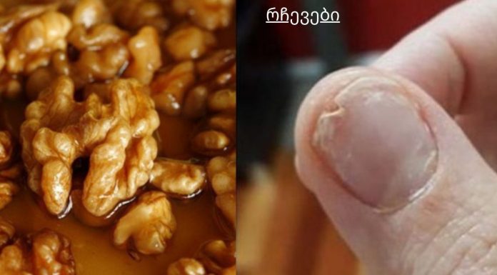 მიირთვით ეს, თუ გაქვთ მტვრევადი ფრჩხილები, უძილობა და ზედმეტი თმის ცვენა