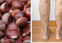 თრომბოზი და ვარიკოზული ვენები იკურნება ხალხური მეთოდებით. წინაპრების სიბრძნე ჯანმრთელობის დაცვის შესახებ!