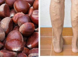 თრომბოზი და ვარიკოზული ვენები იკურნება ხალხური მეთოდებით. წინაპრების სიბრძნე ჯანმრთელობის დაცვის შესახებ!