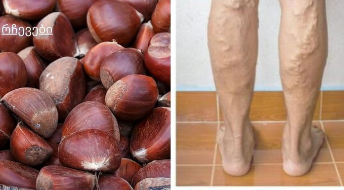 თრომბოზი და ვარიკოზული ვენები იკურნება ხალხური მეთოდებით. წინაპრების სიბრძნე ჯანმრთელობის დაცვის შესახებ!