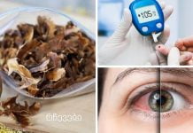 კონიუნქტივიტი, თვალის ინფექციები,დიაბეტი და სხვა დაავადებები.რას მკურნალობს კაკლის ტიხრები?