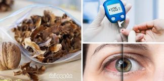 კონიუნქტივიტი, თვალის ინფექციები,დიაბეტი და სხვა დაავადებები.რას მკურნალობს კაკლის ტიხრები?