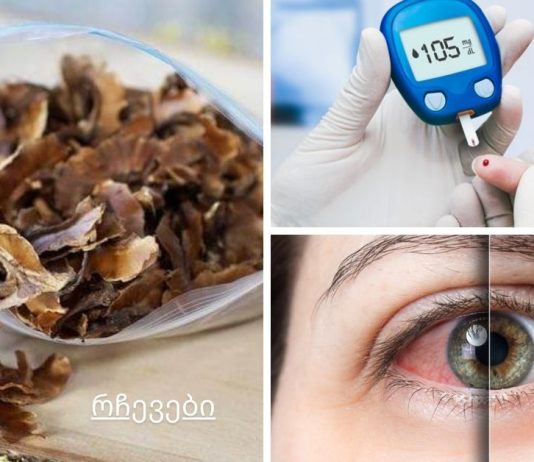 კონიუნქტივიტი, თვალის ინფექციები,დიაბეტი და სხვა დაავადებები.რას მკურნალობს კაკლის ტიხრები?