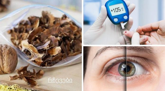 კონიუნქტივიტი, თვალის ინფექციები,დიაბეტი და სხვა დაავადებები.რას მკურნალობს კაკლის ტიხრები?