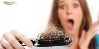 რა უნდა გავაკეთო, თუ თმა გცვივა?