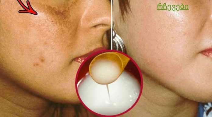 გაანათეთ კანი და გააუმჯობესეთ მისი მდგომარეობა ეფექტური სახლის კრემით