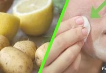 სახეზე მუქი ლაქების მოცილება მხოლოდ 3 ღამეში