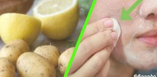სახეზე მუქი ლაქების მოცილება მხოლოდ 3 ღამეში