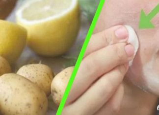 სახეზე მუქი ლაქების მოცილება მხოლოდ 3 ღამეში