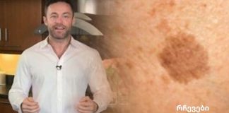 ცნობილი დერმატოლოგის თქმით ამ პროდუქტით შეგიძლიათ მოიშოროთ სახეზე ყავისფერი ლაქები.