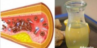 არ დახარჯოთ ერთი თეთრითაც მეტი აბებზე,მაღალი არტერიული წნევის ან “ცუდი” ქოლესტერინის შესამცირებლად. მიიღეთ ეს ერთი კვირის განმავლობაში!