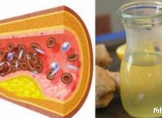 არ დახარჯოთ ერთი თეთრითაც მეტი აბებზე,მაღალი არტერიული წნევის ან “ცუდი” ქოლესტერინის შესამცირებლად. მიიღეთ ეს ერთი კვირის განმავლობაში!