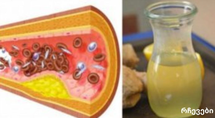 არ დახარჯოთ ერთი თეთრითაც მეტი აბებზე,მაღალი არტერიული წნევის ან “ცუდი” ქოლესტერინის შესამცირებლად. მიიღეთ ეს ერთი კვირის განმავლობაში!