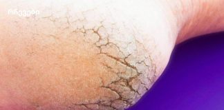 აღარ დახარჯოთ ფული პედიკურზე – მხოლოდ 2 ინგრედიენტი თქვენს სამზარეულოში და თქვენი ფეხები უკეთესად გამოიყურება, ვიდრე ოდესმე!