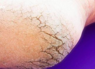 აღარ დახარჯოთ ფული პედიკურზე – მხოლოდ 2 ინგრედიენტი თქვენს სამზარეულოში და თქვენი ფეხები უკეთესად გამოიყურება, ვიდრე ოდესმე!