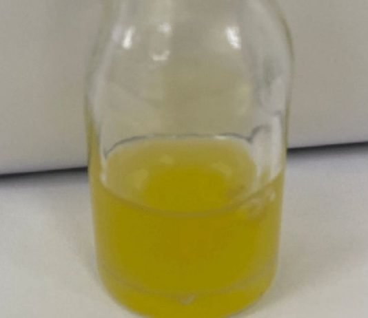 მოიშორეთ ანთება, პარაზიტები, კანდიდოზი და გააუმჯობესეთ სისხლის შემადგენლობა! უბრალოდ დალიეთ კოვზი ამ ნაყენის 1 კოვზი!!