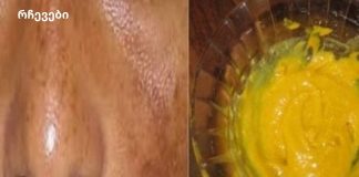 ამ ნარევით ეფექტურად მოიცილეთ მზის სხივების გამო ლაქები და ჰიპერპიგმენტაცია