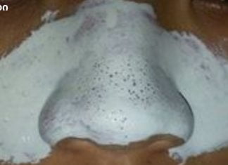 დაემშვიდობეთ აკნეს სულ რაღაც 20 წუთში მხოლოდ ორი ინგრედიენტით!