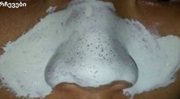 დაემშვიდობეთ აკნეს სულ რაღაც 20 წუთში მხოლოდ ორი ინგრედიენტით!