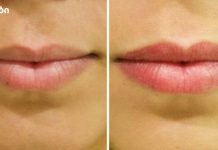 თქვენ შეგიძლიათ გახადოთ თქვენი ტუჩები მშვენიერი და გახდეთ თქვენი ტუჩები ზედმეტი ფულის დახარჯვის გარეშე! ისწავლე როგორ!