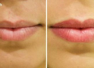 თქვენ შეგიძლიათ გახადოთ თქვენი ტუჩები მშვენიერი და გახდეთ თქვენი ტუჩები ზედმეტი ფულის დახარჯვის გარეშე! ისწავლე როგორ!