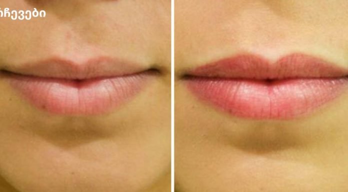 თქვენ შეგიძლიათ გახადოთ თქვენი ტუჩები მშვენიერი და გახდეთ თქვენი ტუჩები ზედმეტი ფულის დახარჯვის გარეშე! ისწავლე როგორ!