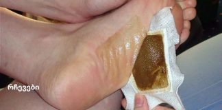 გააკეთეთ დეტოქსის ბალიშები სახლში და მოიშორეთ ორგანიზმში ყველა საშიში ტოქსინი