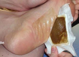 გააკეთეთ დეტოქსის ბალიშები სახლში და მოიშორეთ ორგანიზმში ყველა საშიში ტოქსინი