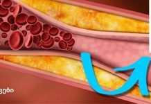 ეს სასმელი გაწმენდს თქვენს არტერიებს და დაიცავს თქვენს გულს!