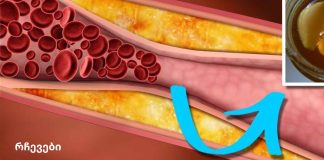 ეს სასმელი გაწმენდს თქვენს არტერიებს და დაიცავს თქვენს გულს!