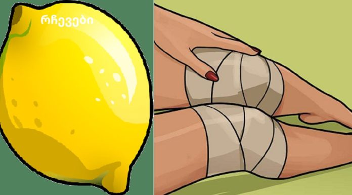 გაწუხებთ მუხლების ტკივილი?გამოიყენეთ ლიმონი მუხლის ტკივილის შესამსუბუქებლად. ᲡᲐᲮᲚᲨᲘ!