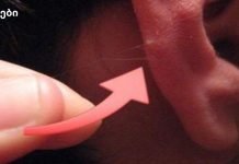 ყურებზე თმა გამაფრთხილებელი ნიშანია! ᲠᲐᲡ ᲜᲘᲨᲜᲐᲕᲡ?