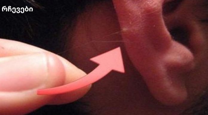 ყურებზე თმა გამაფრთხილებელი ნიშანია! ᲠᲐᲡ ᲜᲘᲨᲜᲐᲕᲡ?