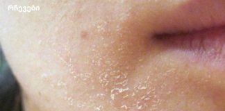 როდესაც სხეული დახმარებას ითხოვს: 10 მნიშვნელოვანი სიგნალი, რომელსაც იგნორირება არ შეგიძლიათ!