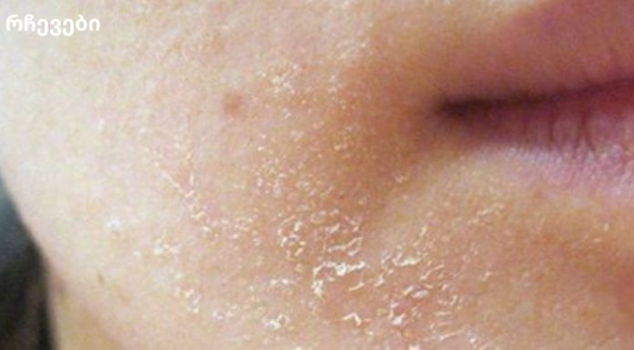 როდესაც სხეული დახმარებას ითხოვს: 10 მნიშვნელოვანი სიგნალი, რომელსაც იგნორირება არ შეგიძლიათ!