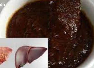 ხილი, რომელიც 30 დღეში ღვიძლს აახლებს, გაიახალგაზრდავეთ ღვიძლი 20 წლით.