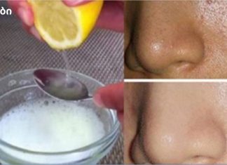 გამოიყენეთ მხოლოდ 2 ინგრედიენტი და თქვენი სახე იქნება უფრო სუფთა ვიდრე ოდესმე!