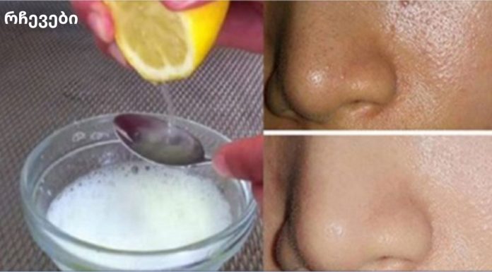 გამოიყენეთ მხოლოდ 2 ინგრედიენტი და თქვენი სახე იქნება უფრო სუფთა ვიდრე ოდესმე!