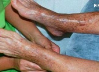 ეფექტური რჩევები ცუდი მიმოქცევის პრობლემის გადასაჭრელად