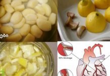 ლიმონისა და ნივრის ნაზავი: ყველაზე ძლიერი გულის გამწმენდი