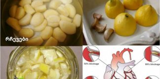 ლიმონისა და ნივრის ნაზავი: ყველაზე ძლიერი გულის გამწმენდი