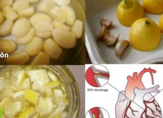 ლიმონისა და ნივრის ნაზავი: ყველაზე ძლიერი გულის გამწმენდი