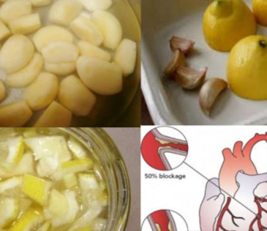 ლიმონისა და ნივრის ნაზავი: ყველაზე ძლიერი გულის გამწმენდი