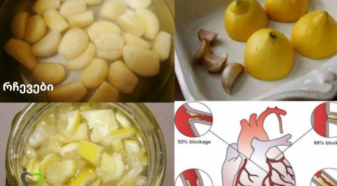 ლიმონისა და ნივრის ნაზავი: ყველაზე ძლიერი გულის გამწმენდი