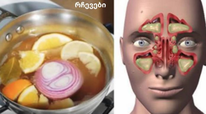 ძლიერი სასმელი, რომელიც მყისიერად წმენდს სასუნთქ გზებს: ცხვირი უფასოა, სუნთქვა სუფთა!