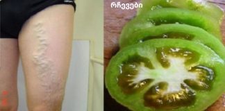 როგორ განვკურნოთ ვარიკოზული ვენები პომიდვრით