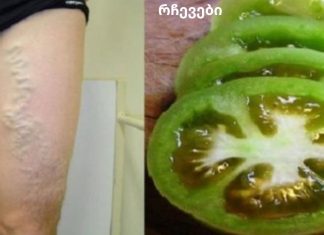 როგორ განვკურნოთ ვარიკოზული ვენები პომიდვრით